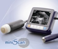 Miniscan wrist ultrasound scanner
