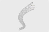 Peripheral Stent System