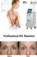 What to expect from your IPL treatment session