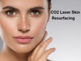 CO2 Laser: The Gold Standard in Skin Resurfacing