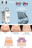 The precautions for cryolipolysis treatment