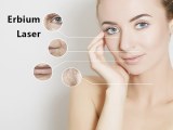 What you should know about erbium laser skin resurfacing