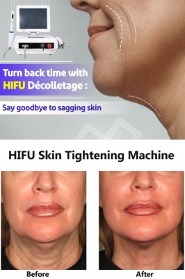 Things You Should Know About the HIFU Facial