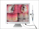M-998(2-in-1) Intraoral Camera+self-contained 19inch LED monitor