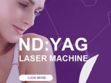 Procedure for Q Switch ND YAG Laser Treatment