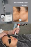3 Major Things To Know About The Picosecond Laser Treatment Process