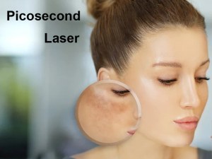 Picosecond Laser Treatments Timeline