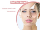 Picosecond Laser Can Achieve the Skin of Your Dreams