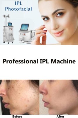 What Is IPL Treatment: How it Works, Results, and More