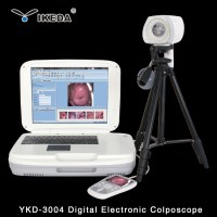 Ykd-3003 Portable Digital Colposcope with Camera for Clinic