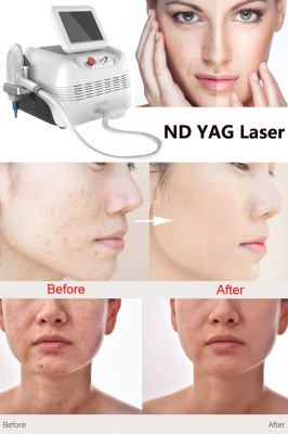 Nd YAG laser for the aesthetic treatment of patients with pigmented skin disorders